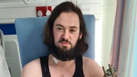 Mike Barley A young man, with long dark brown hair and a brown beard and moustache , sits next to a hospital bed. He has a bandage on his neck.