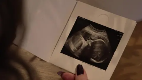 Sonographer scan photo of an unborn baby