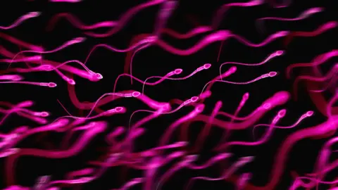 Getty Images Graphical representation of sperm in bright pink against a dark background. The sperm have an arrow shaped head and a long wriggly tail. Dozens of them are swimming right to left, with some in focus and some blurred creating a depth of field 