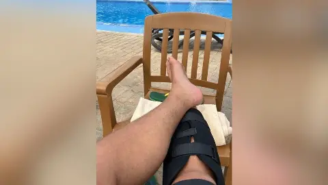 Hudgell Solicitors Man's legs by a pool one is in a black brace.