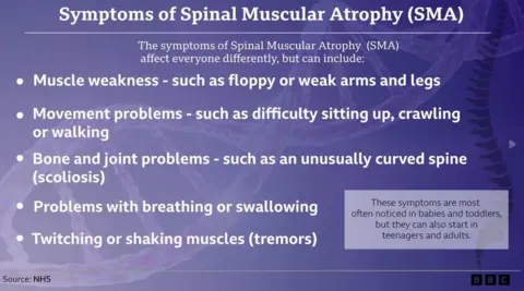 A graphic showing the symptoms of Spinal Muscular Atrophy (SMA). The background is purple and there are five bullet points in white text.
The headline reads: Symptoms of Spinal Muscular Atrophy (SMA). Under this it says: "The symptoms of Spinal Muscular Atrophy (SMA) affect everyone differently, but can include:
- Muscle weakness - such as floppy or weak arms and legs
- Movement problems - such as difficulty sitting up, crawling or walking
- Bone and joint problems - such as an unusually curved spine (scoliosis)
- Problems with breathing or swallowing
- Twitching or shaking muscles (tremors)
There is a box which in it reads: "These symptoms are most often noticed in babies and toddlers, but they can also start in teenagers and adults."
